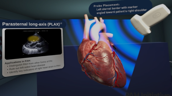 Cardiac echo imaging animated video thumbnail