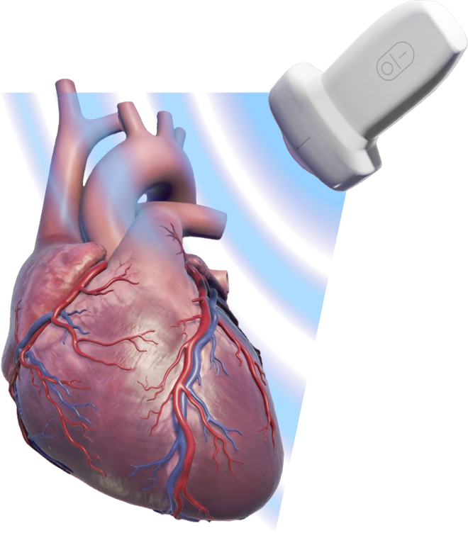 Echo assessment of the right heart and rv function