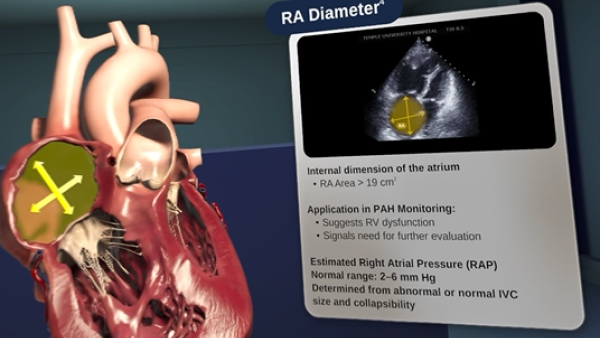Normal and abnormal echo parameters video thumbnail