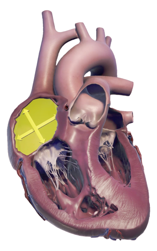 Right atrium size structure and functional measures
