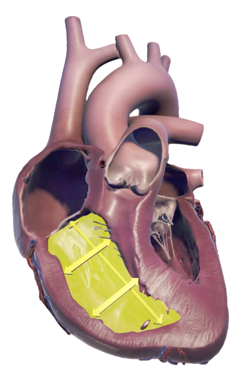 Right ventricle size structure and measures