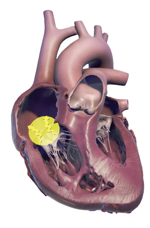 TRV anatomy diagram