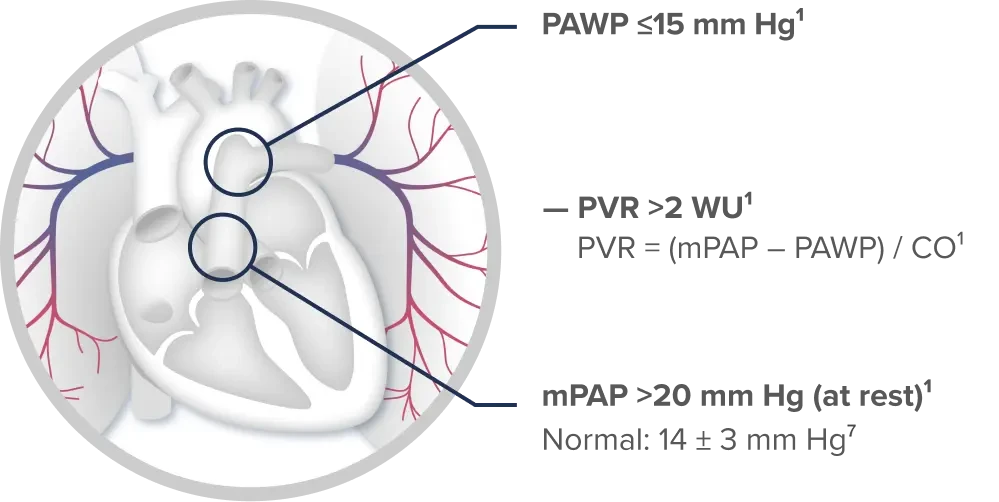 Right heart catheterization diagram showing PAWP, PVR, and mPAP values