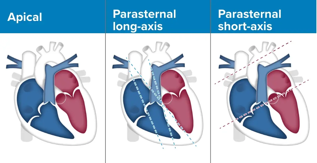 Table showing views that can be captured from Echo assessments