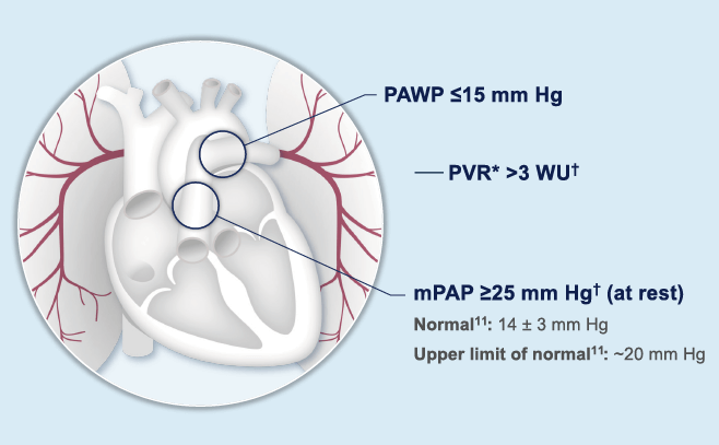 Illustration of right heart catheterization definitive diagnosis of WHO Group 1 PAH