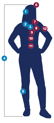 Body illustration showing the location, number labeling and body part affected by the early and late nonspecific symptoms of PAH