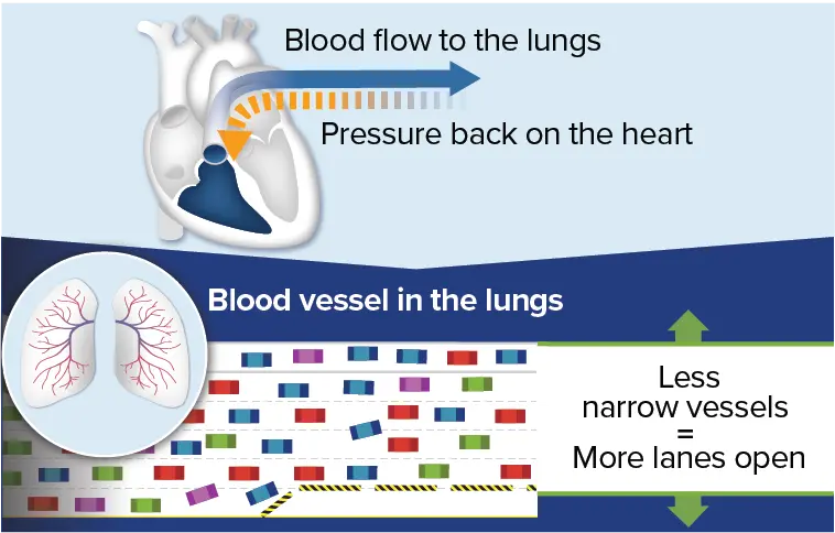 Blood flow in blood vessels after PAH treatment
