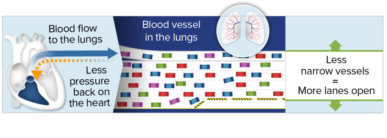 Blood flow in blood vessels after PAH treatment